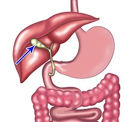 Gallbladder Surgery